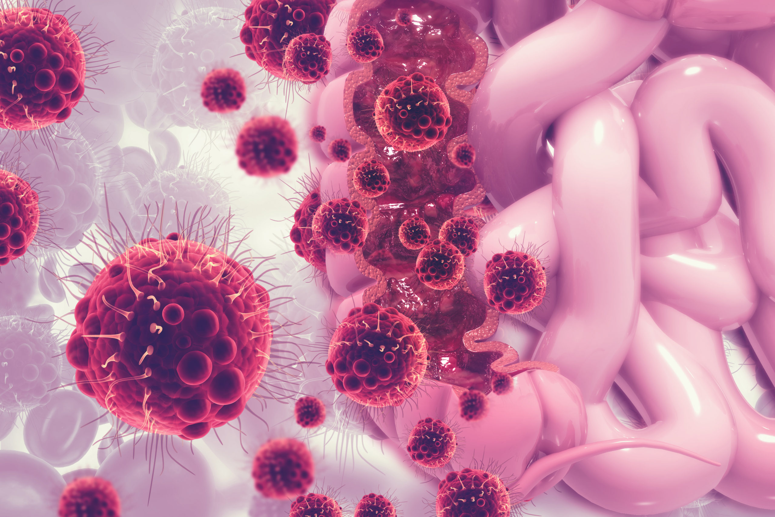 Colon cancer. Cancer attacking cell. Colon disease concept. 3d illustration