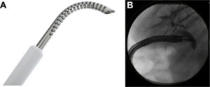 Steerable EUS-guided biliary access device