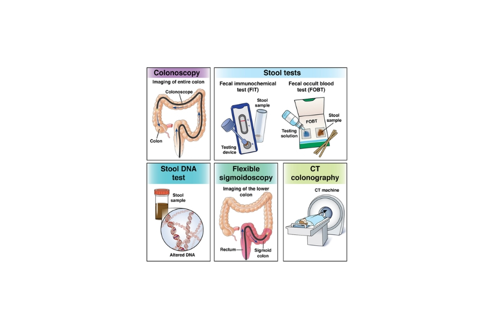 Approach to the use of noninvasive colorectal cancer (CRC) screening options