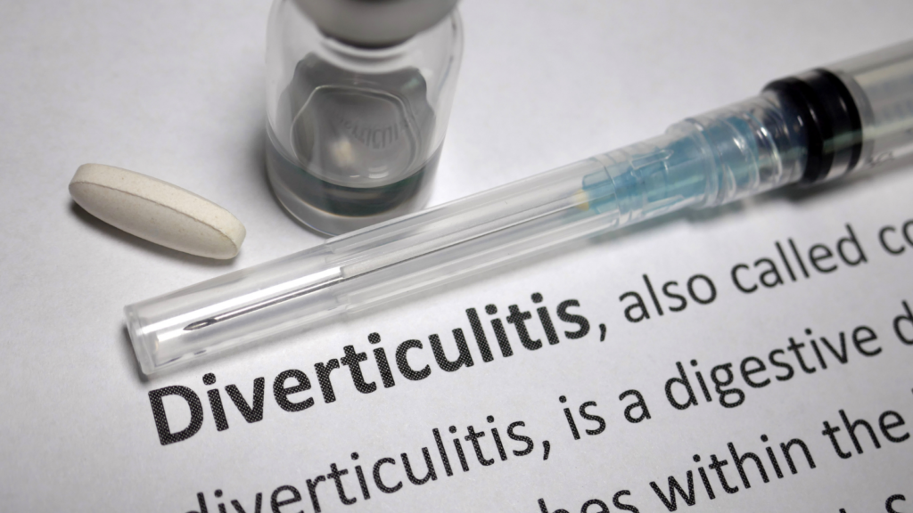 Management of acute diverticulitis