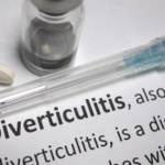 Management of acute diverticulitis