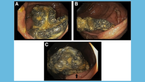 Gastroenterology Image Challenge