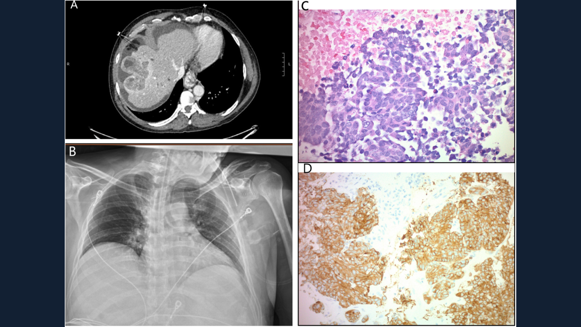 Image challenge - liver mass