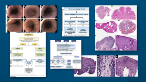 Clinical guidance roundup: Various flowcharts and images from guidance