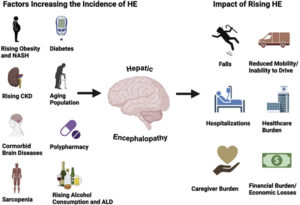 Changing Epidemiology of Cirrhosis and Hepatic Encephalopathy