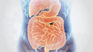 Medical Image of Intestines