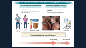 AGA Guideline Spotlight: Biomarkers in Ulcerative Colitis