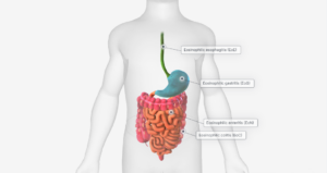 3D image of body - part of EGIDs Gastro Quest course