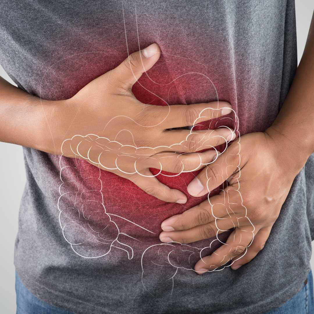 Implementing Standards of Care for Chronic Constipation graphic