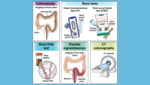 CRC graphic from AGA GI Patient Center