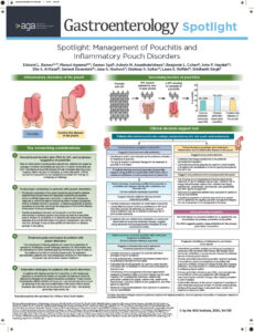 Pouchitis spotlight infographic