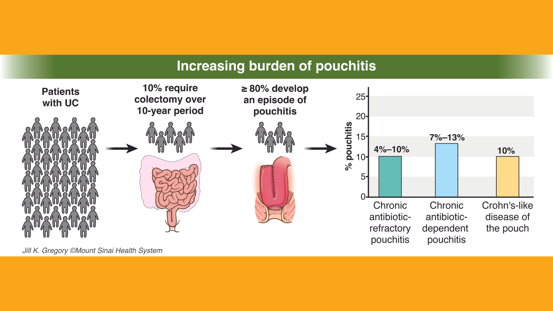 Increasing burden of pouchitis