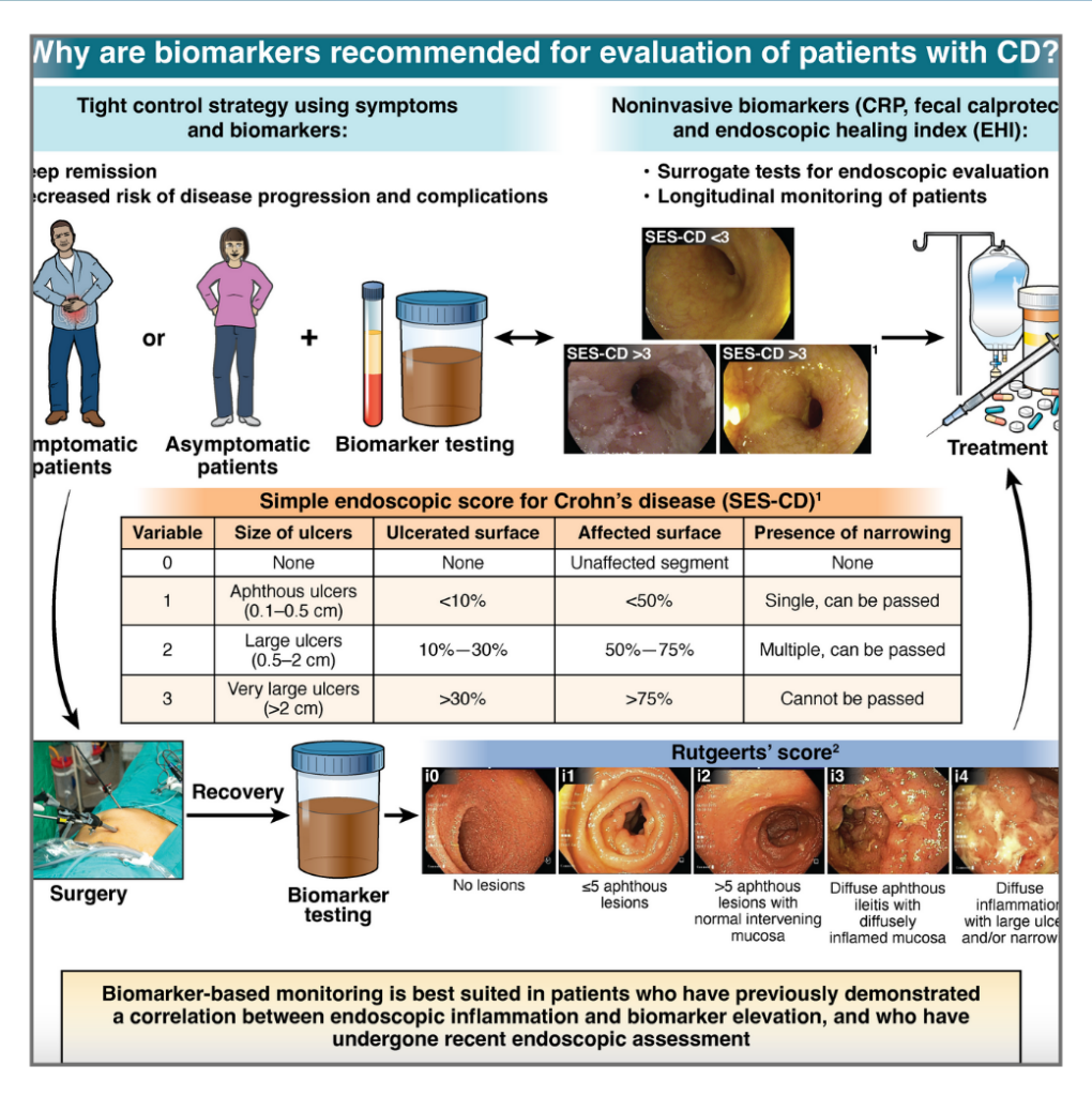 Crohn's disease toolkit - American Gastroenterological Association