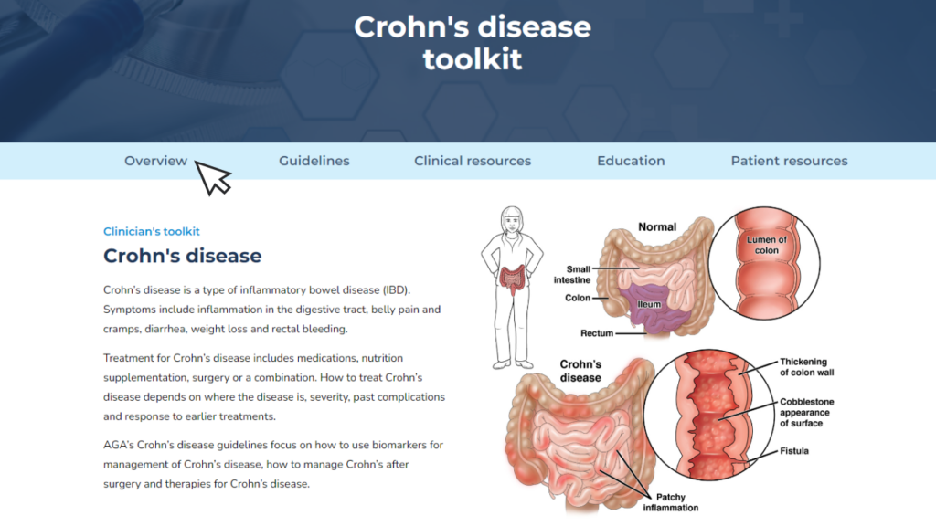Crohn's disease toolkit