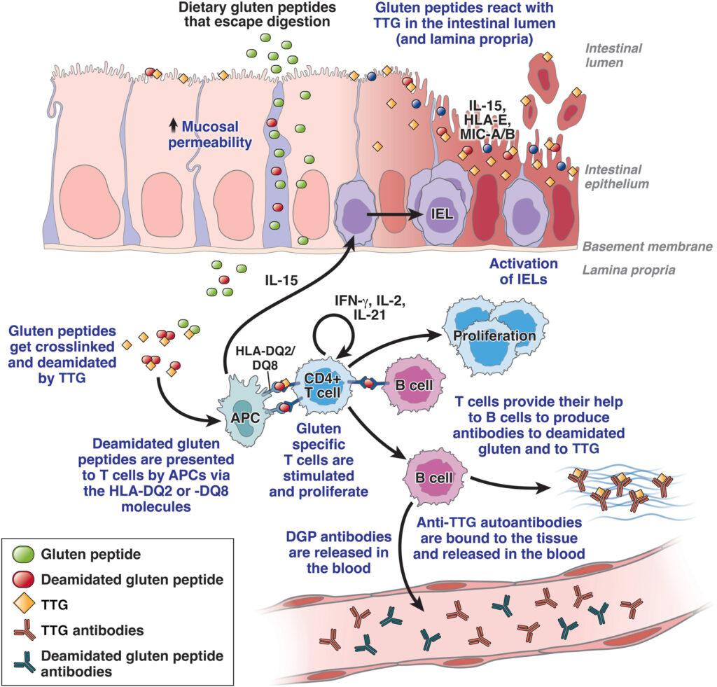 Pathogenesis of CeD