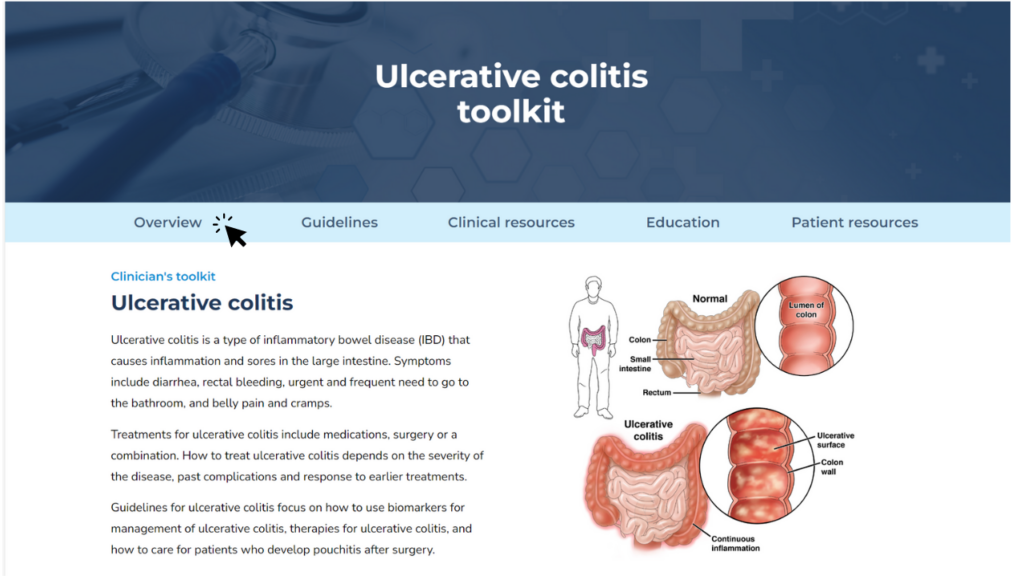 Ulcerative colitis toolkit webpage