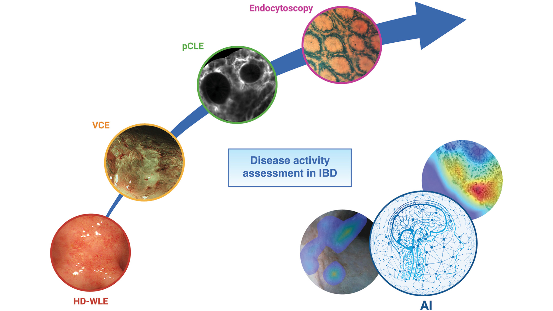 Best practices for using IBD endoscopic scoring systems - American ...