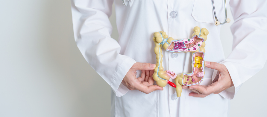 Doctor holding human Colon anatomy model. Colonic disease, Large Intestine, Colorectal cancer, Ulcerative colitis, Diverticulitis, Irritable bowel syndrome, Digestive system and Health concept
