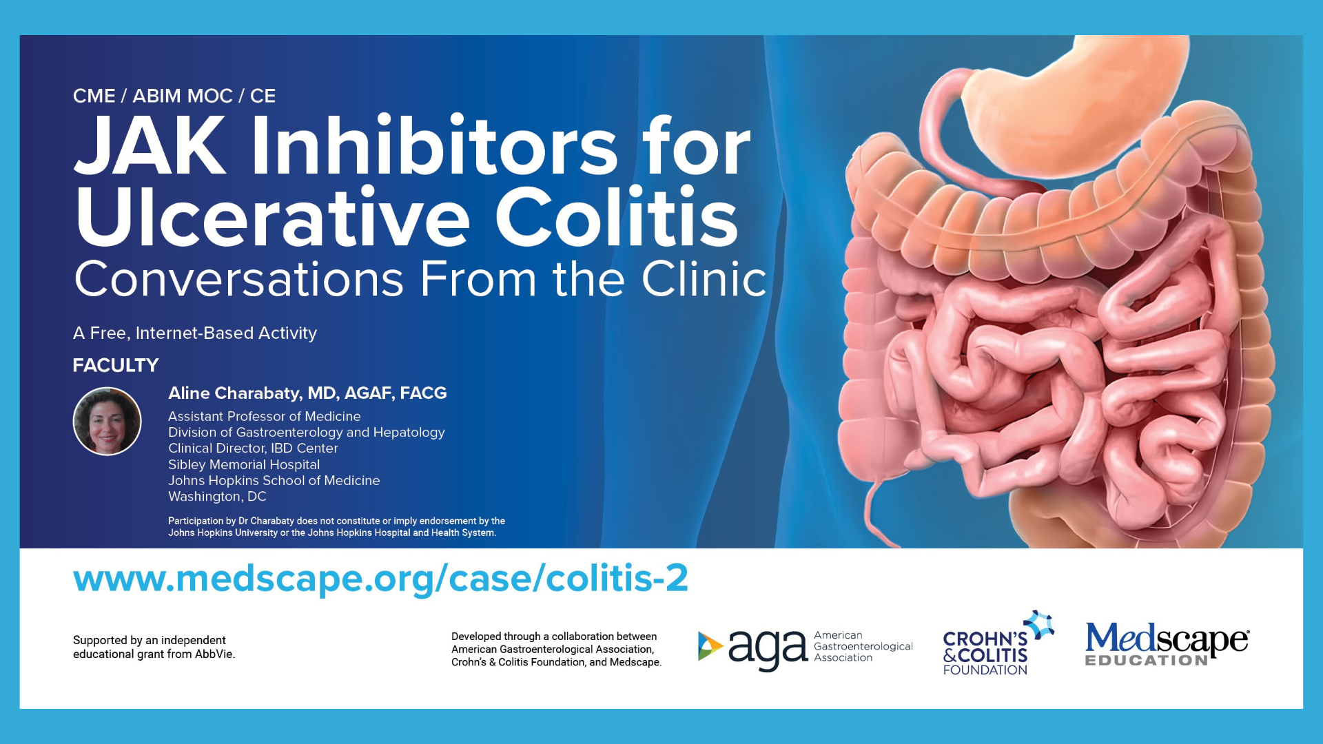JAK inhibitors for ulcerative colitis