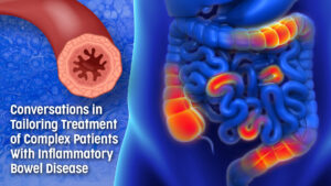 Medical illustration of IBD inflammation. Boost your IBD expertise — register now.