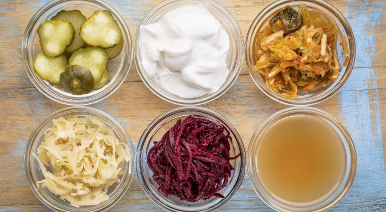Fermented Food Collection
