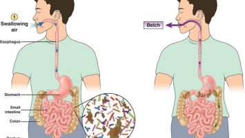 CGH-Gas-PatientEd CGH-Gas-PatientEd