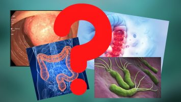 Gi-Disorders-1920×1080-1 Gi-Disorders-1920x1080-1