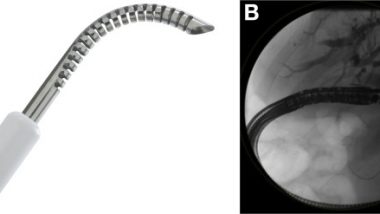 Steerable EUS-guided biliary access device