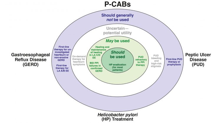 Chart when to use PCABs