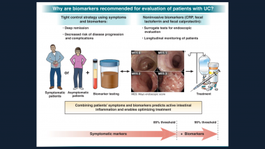 AGA Guideline Spotlight: Biomarkers in Ulcerative Colitis