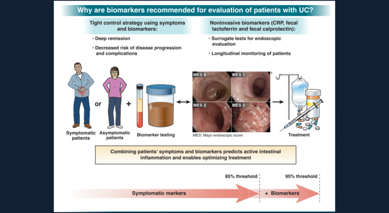 AGA Guideline Spotlight: Biomarkers in Ulcerative Colitis