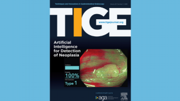 tige_issue TIGE